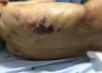 Polícia resgata 50 vítimas de cárcere e tortura em clínica clandestina