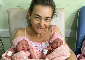 Paciente em Teresina dá à luz gêmeas em gestação extremamente rara