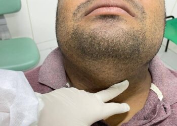 FMS alerta para sinais de câncer bucal e reorganiza atendimento