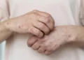 Ataque de abelhas: saiba como agir e identificar sinais de gravidade